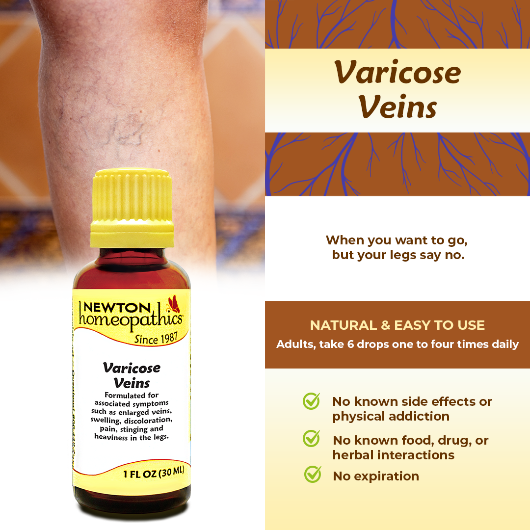 Varicose Veins