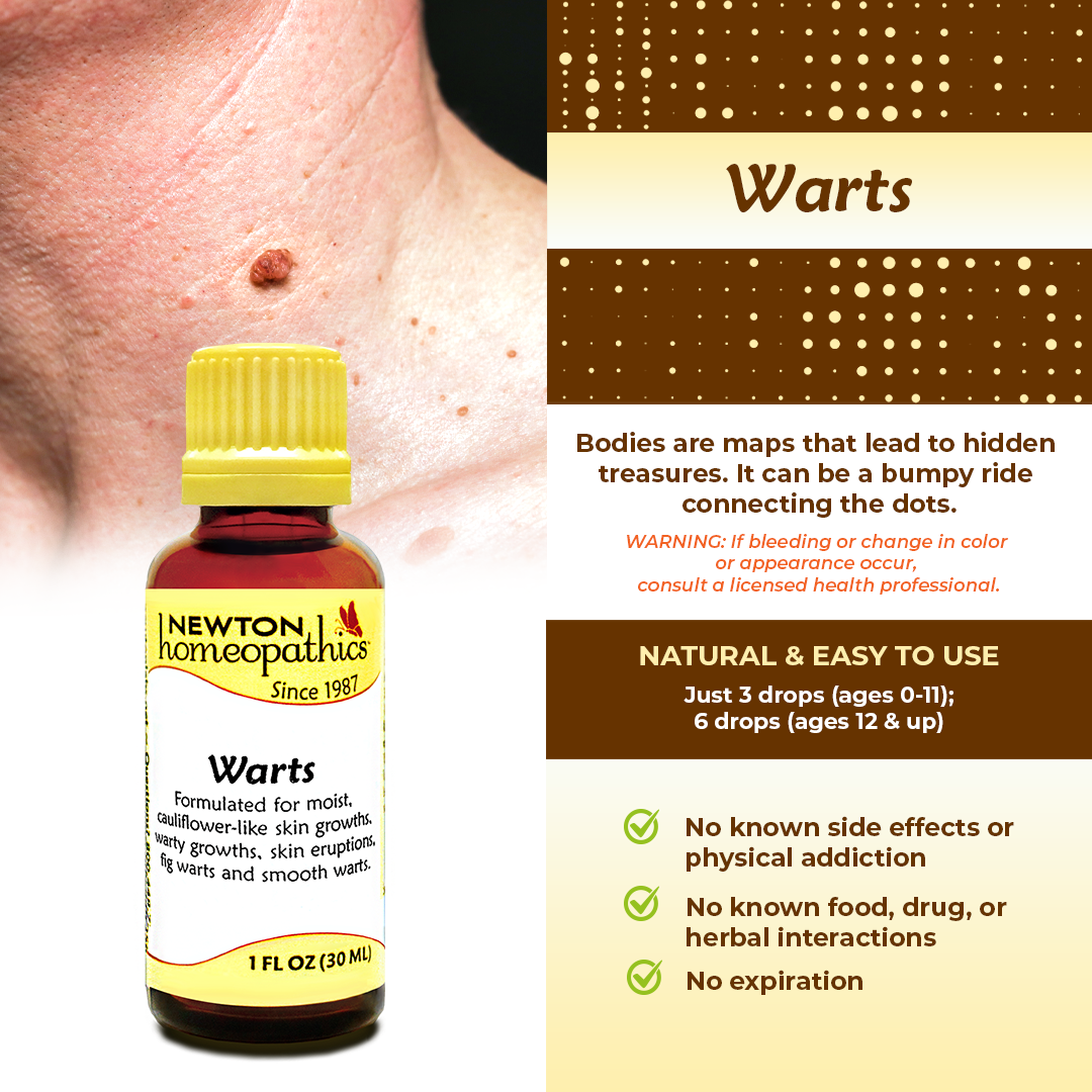 Warts