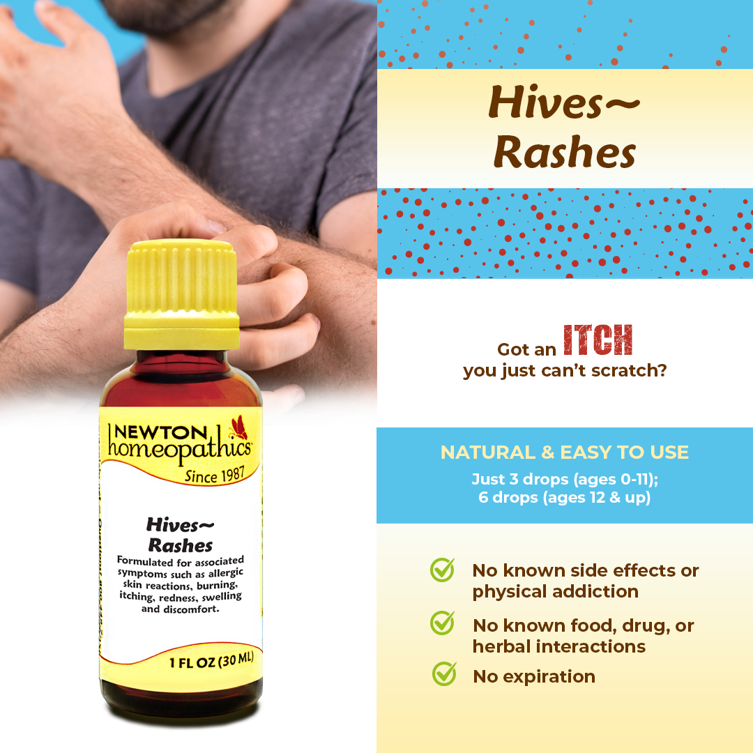 Hives ~ Rashes