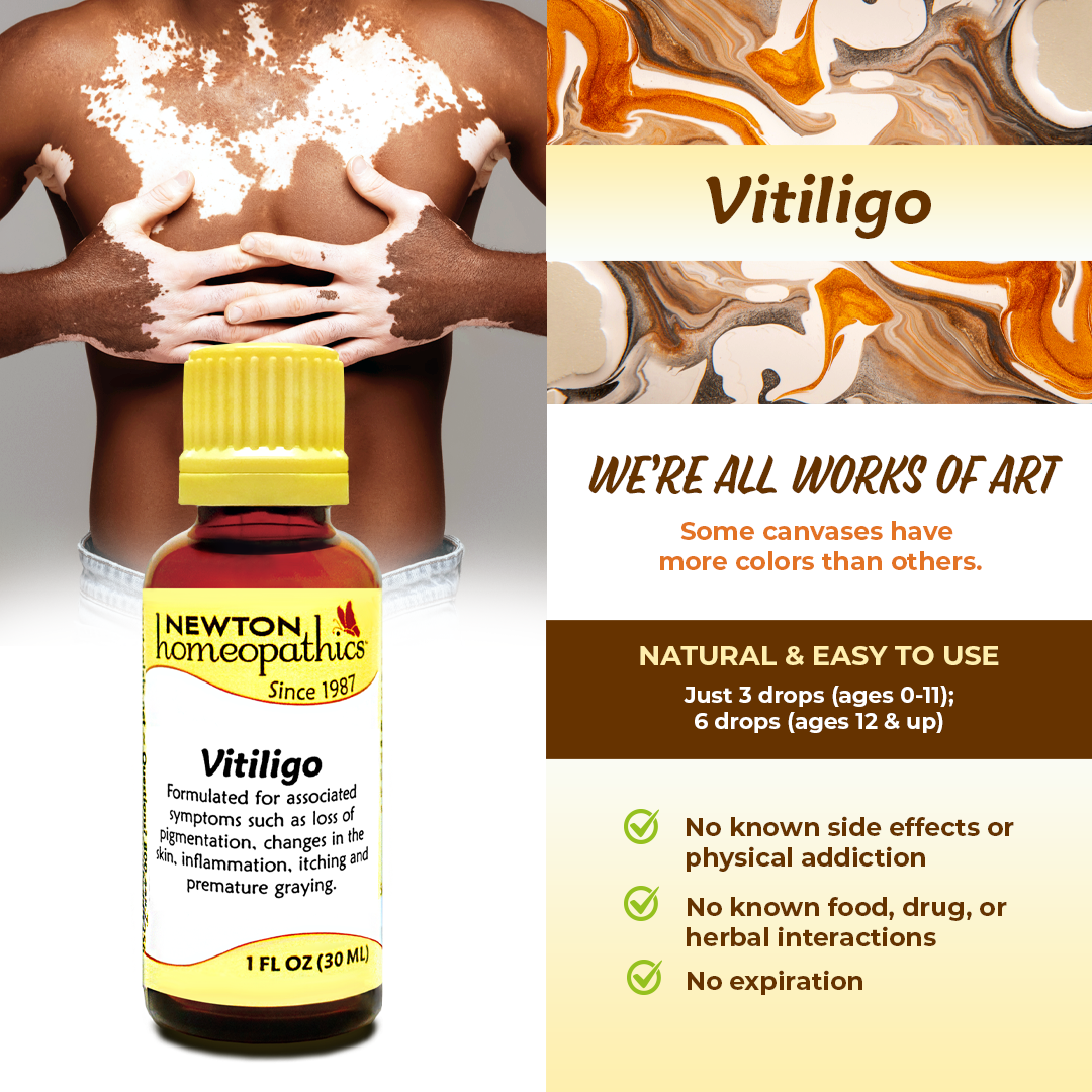 Vitiligo